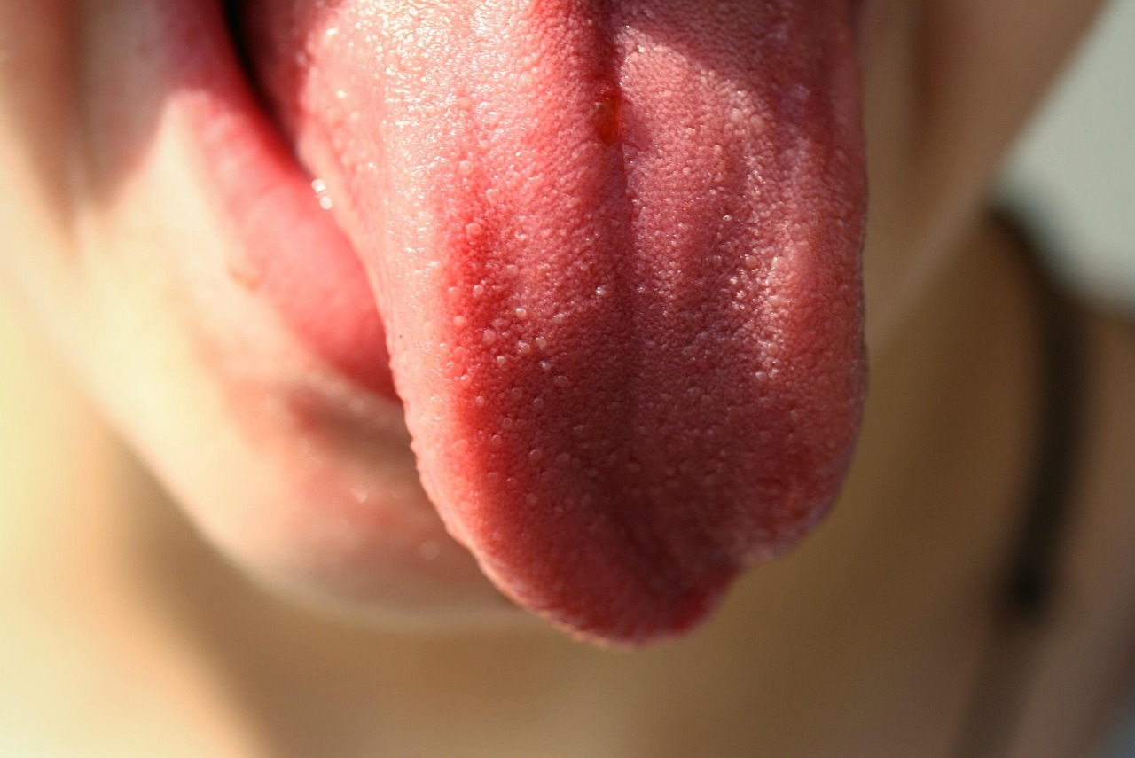 entdecken sie die bedeutung der zungenfarbe! erfahren sie, was verschiedene farben über ihre gesundheit aussagen können und wann es ratsam ist, einen arzt aufzusuchen.